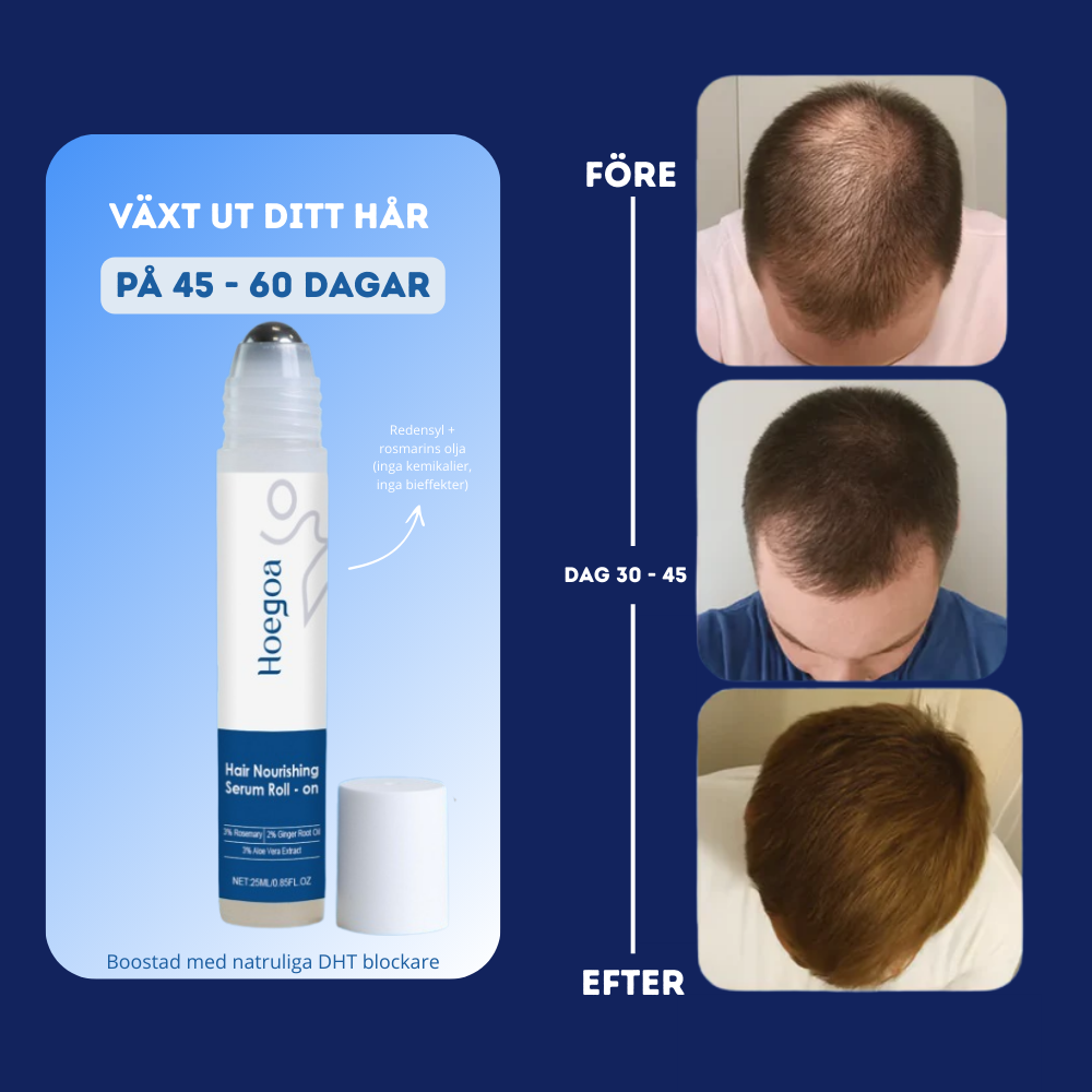 Anti Håravfalls Serum - Få tillbaka håret och självförtroendet