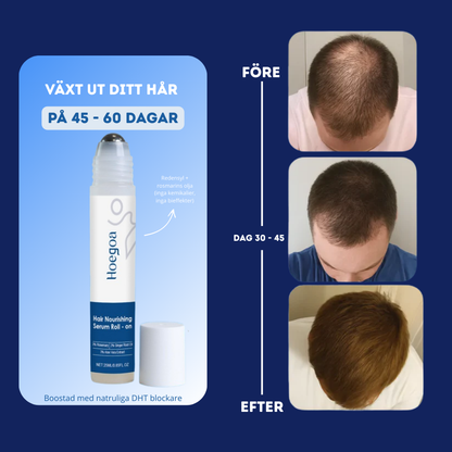 Anti Håravfalls Serum - Få tillbaka håret och självförtroendet